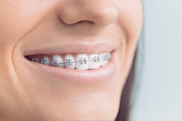 Best Traditional Braces  in Crittenden, KY